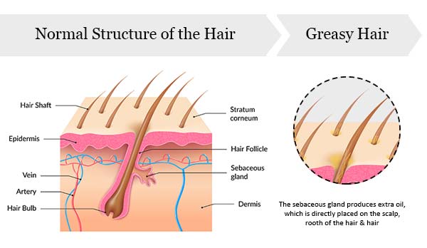Greasy Hair | Top Tips to get rid of ᐅ Blogsplendor
